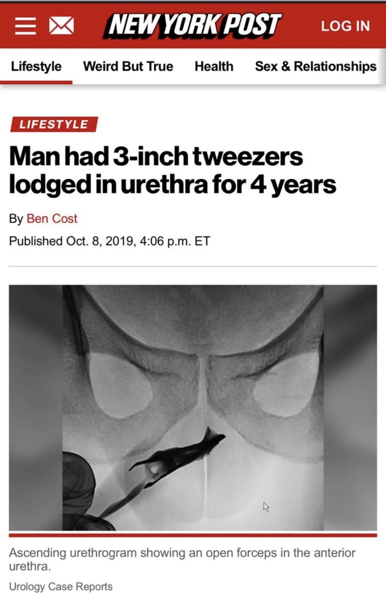New York Post coverage